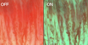 Hemoglobin modus - Optimaliser bildeytelsen i blodfylte felt ved å forbedre kontrast- og strukturgjenkjenning, og støtter kontinuerlig visualisering når blødning er tilstede.